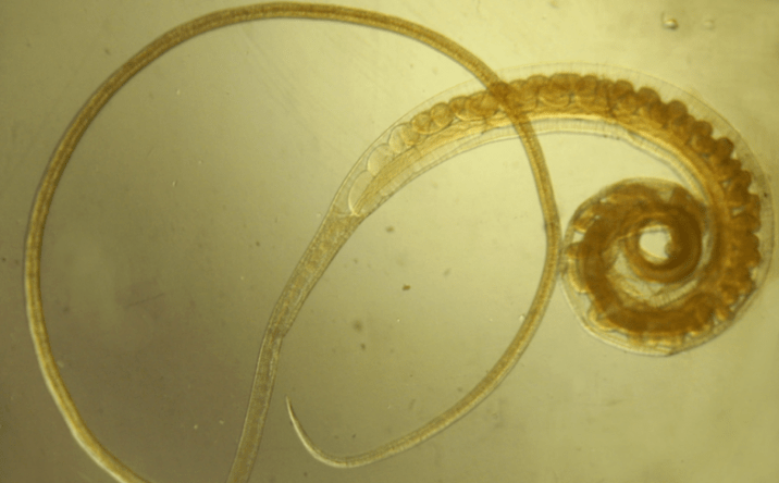 Ανθρώπινος σκουλήκι - ένας έλμινθος που επηρεάζει τους εφήβους