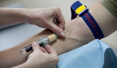 Πώς να προετοιμαστείτε για τη δοκιμή των παρασίτων