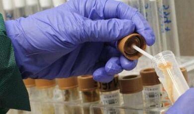 την ανάγκη να περάσει η ανάλυση των παρασίτων