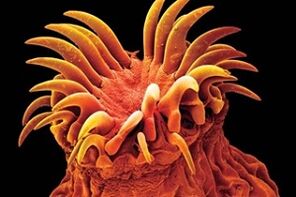 Τρηματώδη παράσιτα στον άνθρωπο