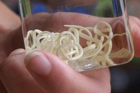 παράσιτα από το ανθρώπινο σώμα