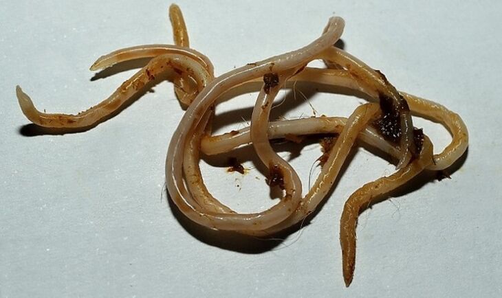 τοξοκάρα από το ανθρώπινο σώμα